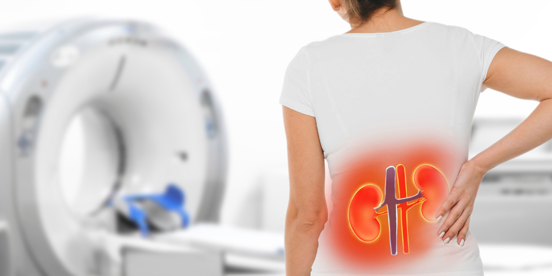 Cólica renal ou dor lombar comum? Saiba quando procurar um urologista