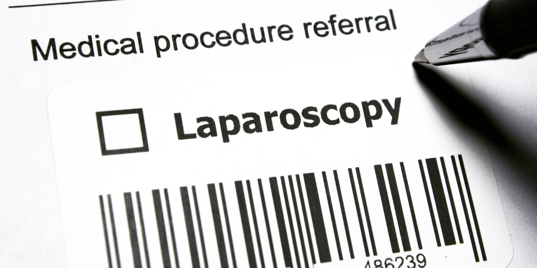 Laparoscopia: entenda o que é e como é feita